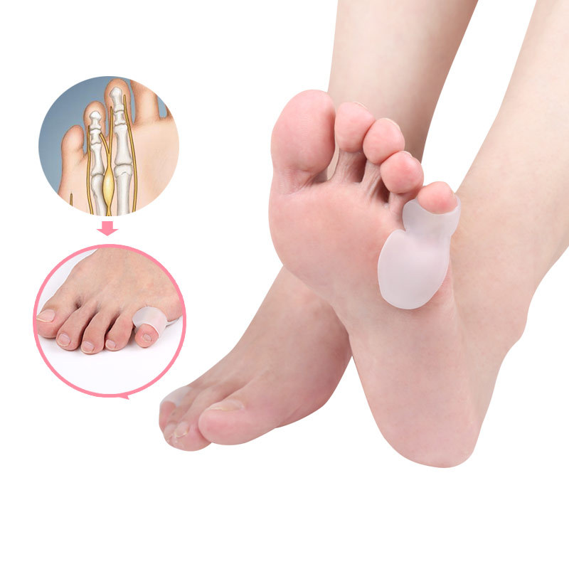 Spot Little Toe Varus Toe Separator Little Toe Correction Silicone Pad Sheath Overlapping Toe Separator