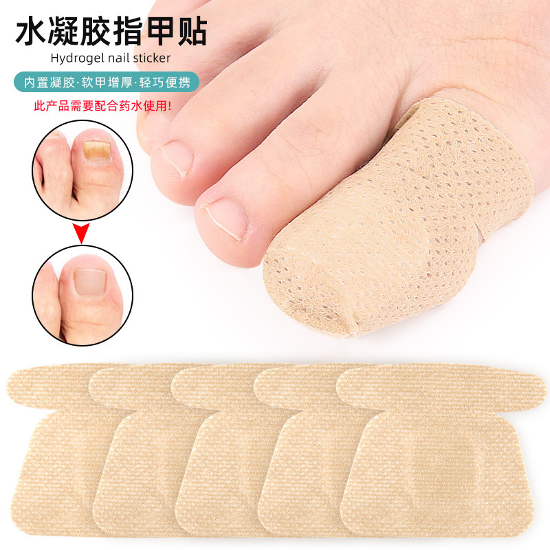 Amazon Hydrogel Nail Repair Patch Toenail Care Soft Nail Ingrown Nail Thickening Nail Groove Gel Nail Patch