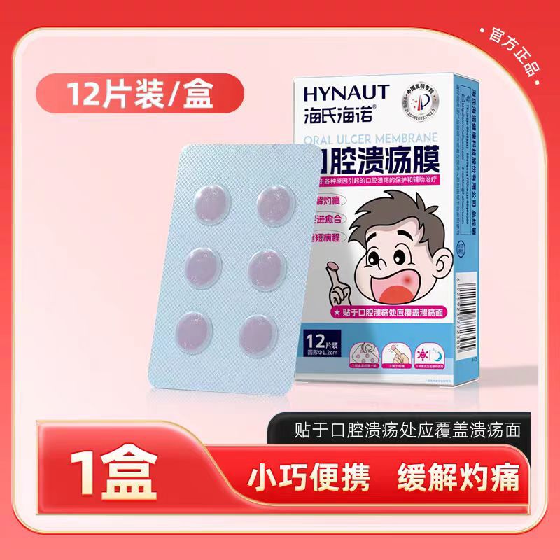 Heshe Hainuo oral ulcer film is suitable for oral ulcer protection and auxiliary treatment of oral ulcer film