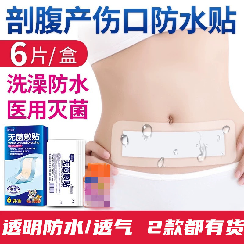 Haishi hainuo sterile patch cesarean wound waterproof patch postoperative knife edge scar bath patch