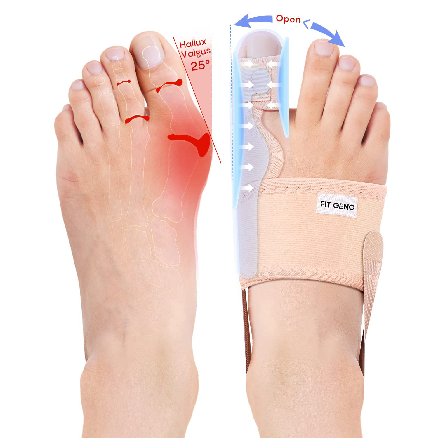 Cross-Border Bunion Corrector, Big Toe Bone Protrusion, Overlapping Toe Separator, Toe Separator, Fixed Correction Band